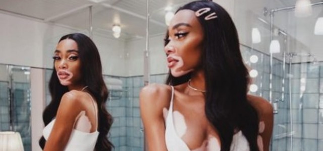 Puma Kyron má novou tvář: Winnie Harlow